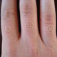 Illustration for article titled Guy Uses Laser-Etch Machine to Tattoo Himself (Verdict: Flaming Nutcase)